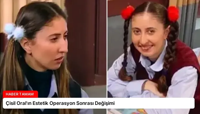 Çisil Oral’ın Estetik Operasyon Sonrası Değişimi